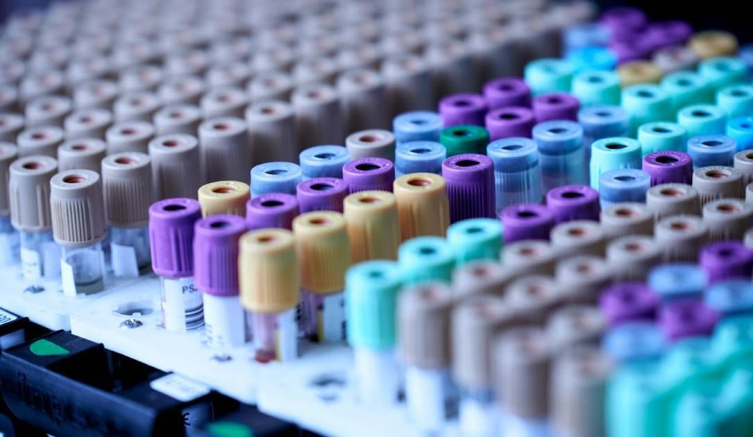 Labcorp to overhaul data security practices, pay $2.3 million fine for cybersecurity failings